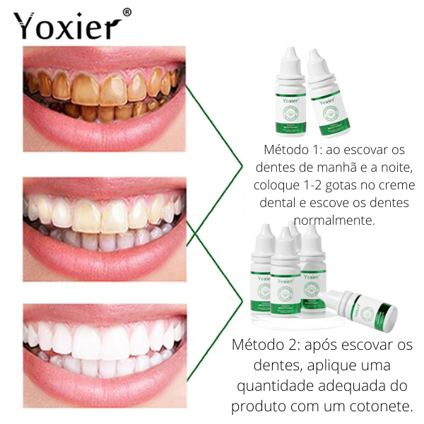 Clareador dental - ELEVE SUA ALTO ESTIMA, SORRINDO MAIS E SEM MEDO.